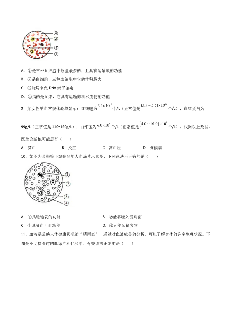 探究题04观察人血永久涂片-七年级生物下册教材实验探究必刷题（人教版）（原卷版）_初中全科电子版试卷练习试题_生物_生物人教版7下练习_人教生物7年级下专项练习16份