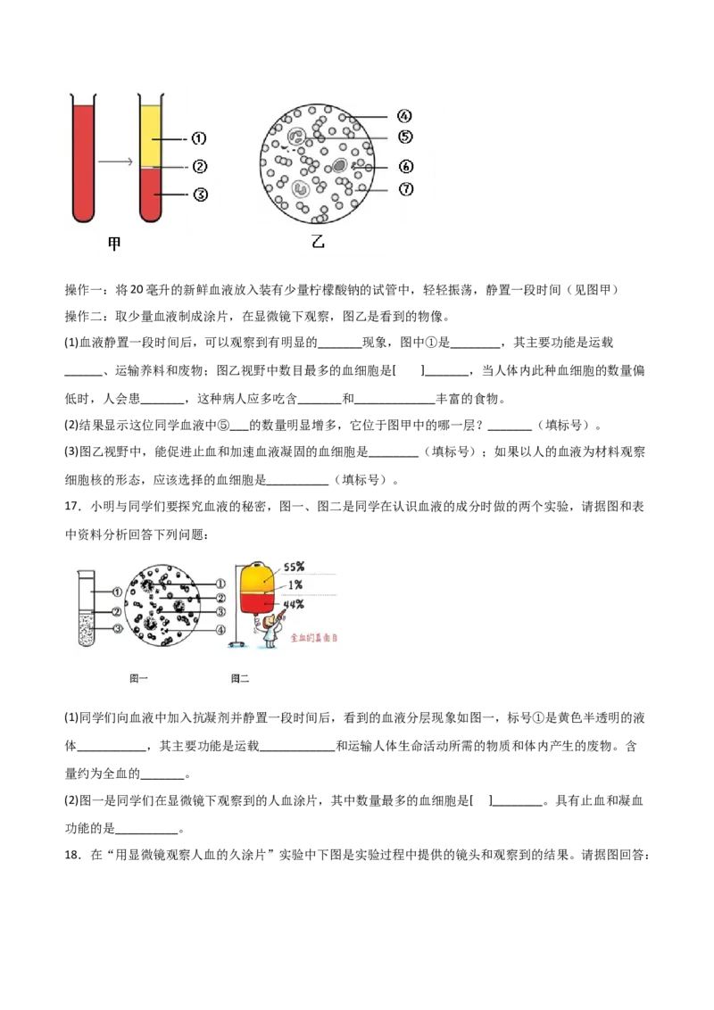 探究题04观察人血永久涂片-七年级生物下册教材实验探究必刷题（人教版）（原卷版）_初中全科电子版试卷练习试题_生物_生物人教版7下练习_人教生物7年级下专项练习16份