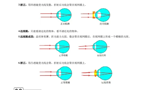 第5.4课时眼睛和眼镜（解析版）_初中全科电子版试卷练习试题_物理_8年级上册物理试题_人教版物理八年级上课时练习（104份）_课时练习第2套25