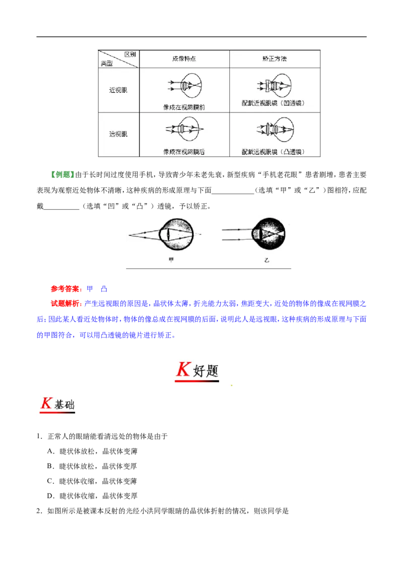 专题5.4眼睛和眼镜-初中物理同步讲义_初物_人教版初中物理初二三同步讲义习题练习八九年级电子资料word素材_20250116_181533_最新人教版初中物理初二上册