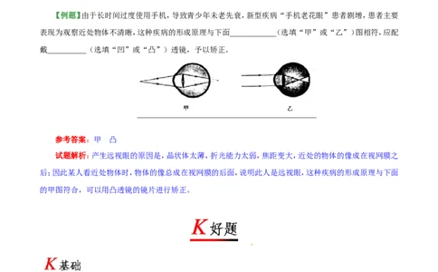 专题5.4眼睛和眼镜-初中物理同步讲义_初物_人教版初中物理初二三同步讲义习题练习八九年级电子资料word素材_20250116_181533_最新人教版初中物理初二上册