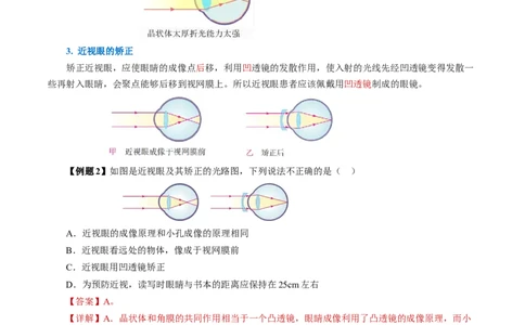 5.4眼睛和眼镜（导学案）教师版_初物_八年级上下册+九年级全一册物理_八年级物理上册_导学案（完）