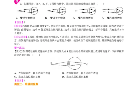 眼睛和眼镜显微镜和望远镜（提高）知识讲解_初物_1初中物理_4初二物理人教版知识导学