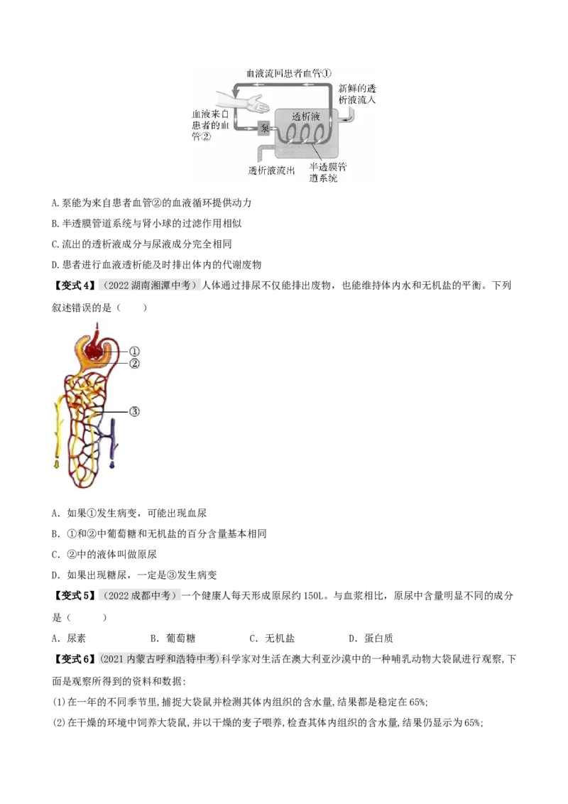 专题14人体内废物的排出（原卷版）_6生物中考复习_2023年中考复习资料_专项复习_2023年中考生物总复习真题探究与变式训练（全国通用）