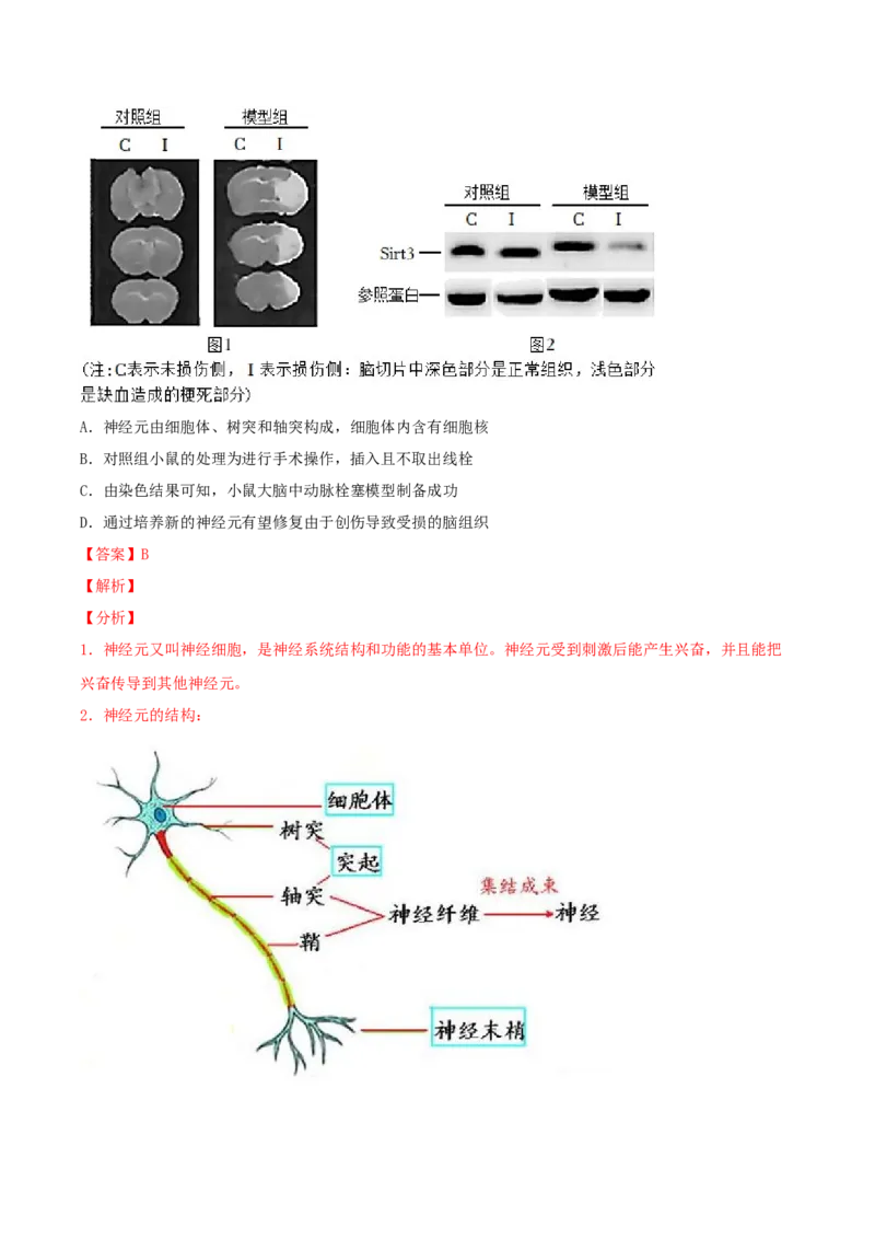 专题15人体生命活动的调节（解析版）_6生物中考复习_2023年中考复习资料_专项复习_2023年中考生物总复习真题探究与变式训练（全国通用）