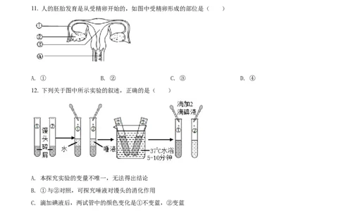 精品解析：2022年山东省临沂市中考生物真题（原卷版）_6生物中考复习_2025中考复习资料_中考真题（近三年）_2022年生物中考真题114份_精品解析：2022年山东省临沂市中考生物真题