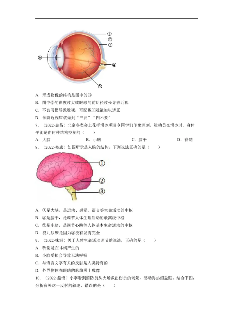 重难点05生物圈中的人（三）-2023年中考生物热点&middot;重点&middot;难点专练（全国通用）（原卷版）_6生物中考复习_2023年中考复习资料_专项复习