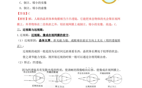 5.4眼睛和眼镜（知识点+例题）(解析版)_1、初中学习资料_4-4、物理_4-4-3、初二物理上册_人教版物理八年级上课时练习（104份）_课时练习第1套53