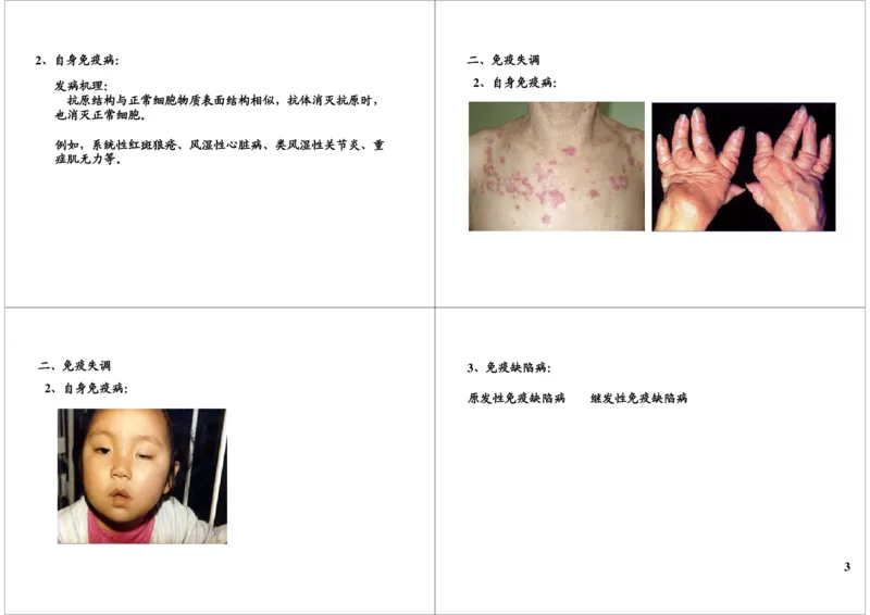 《免疫-免疫失调（一轮下）-b538ea712b41_学而思高三全套_高三录播课程各种版本_高三一轮二轮_29709-56高考生物一轮总复习（必修+选修1、3）_第33讲：免疫-免疫失调（一轮下）》第3页预览
